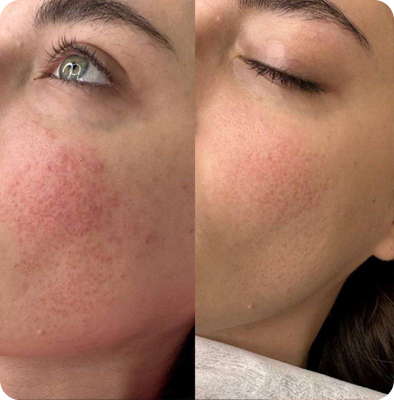 фотолечение Гомель